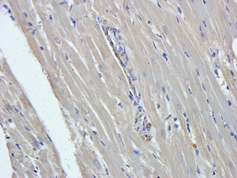 CD274 antibody