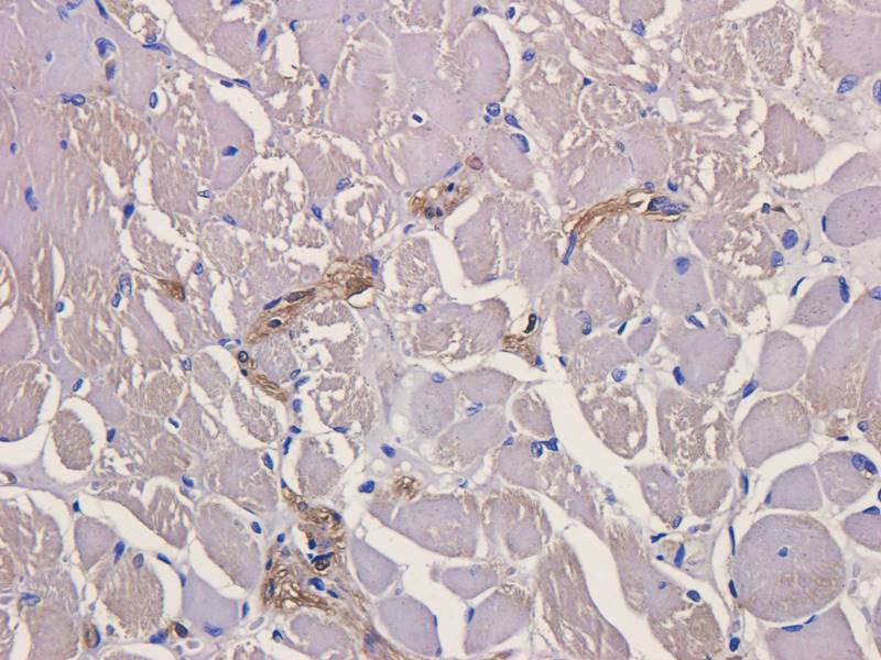 CD28 antibody