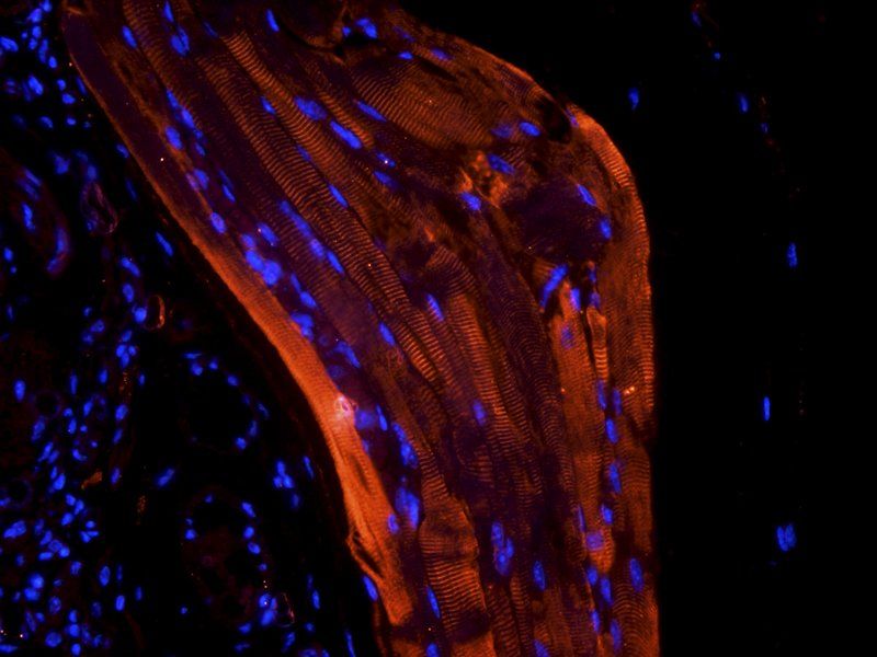 CD303 antibody