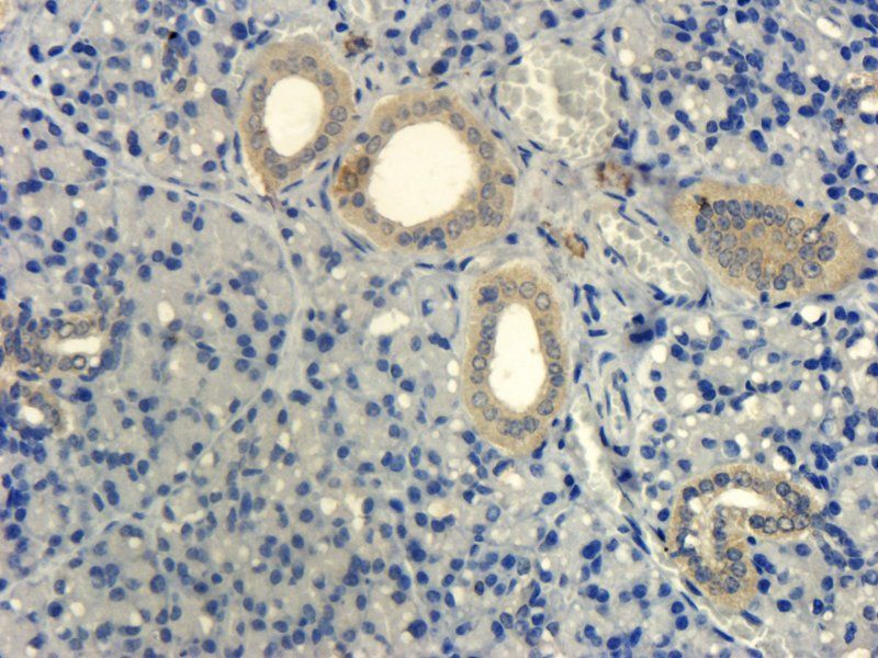CD303 antibody