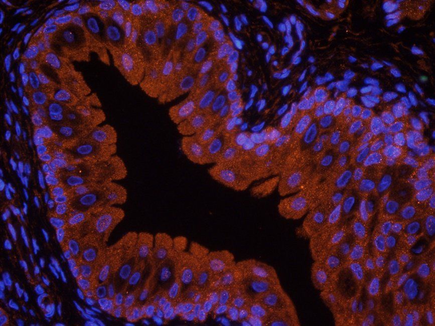 CD32b antibody