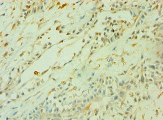 CD33 Antibody