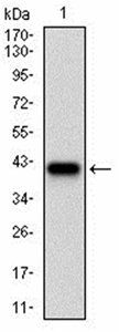 CD36 Antibody