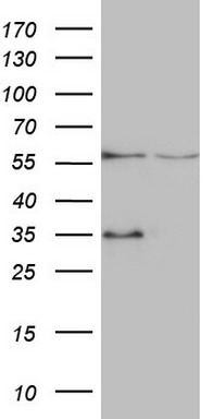 ENTPD1 Antibody