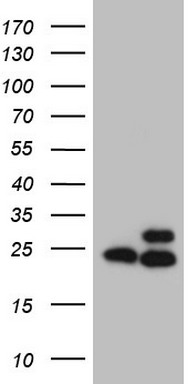 CD39 Antibody