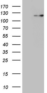 CD39 Antibody