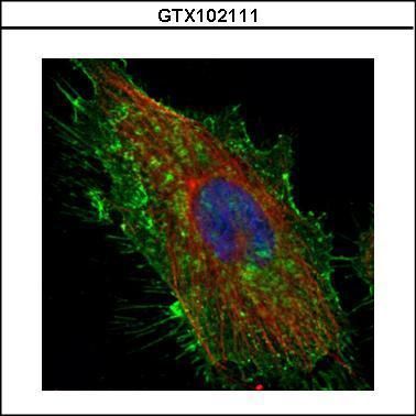 CD44 Rabbit Polyclonal Antibody