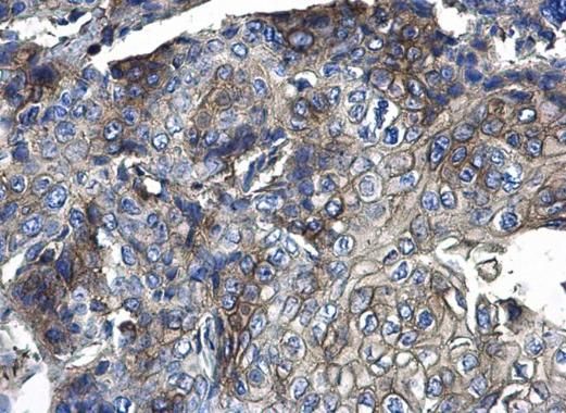 CD44 Rabbit Polyclonal Antibody