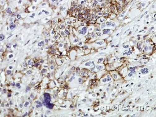 CD44 Rabbit Polyclonal Antibody