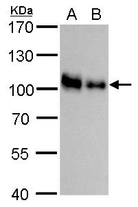 CD44 Rabbit Polyclonal Antibody