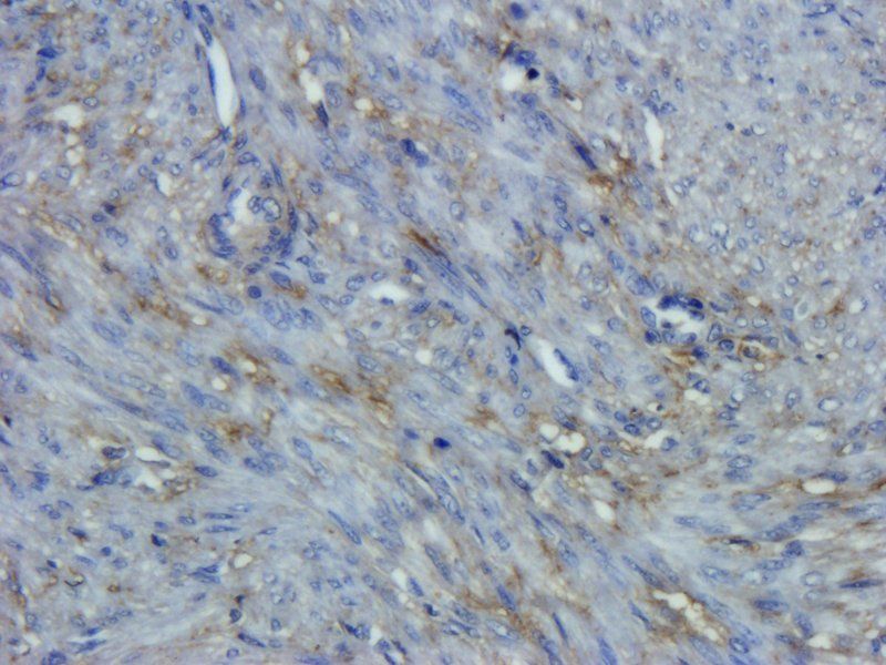 CD44 antibody