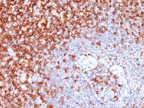 PTPRC Antibody