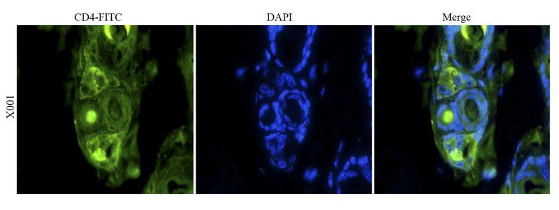 CD4 Rabbit Polyclonal Antibody (FITC)