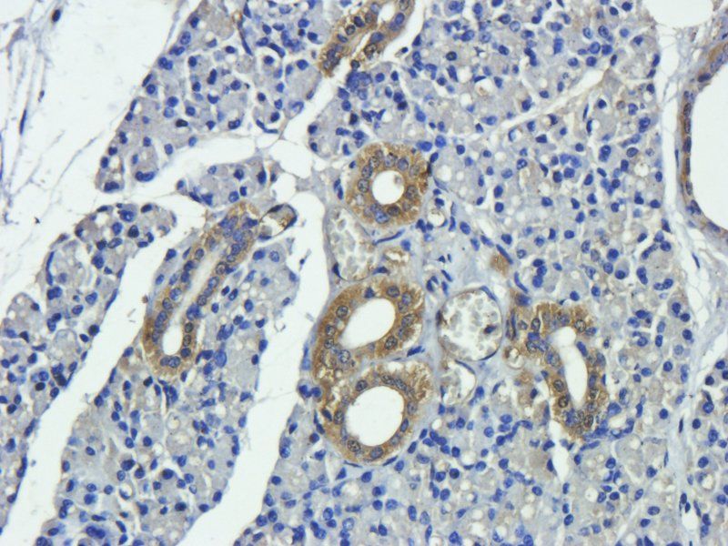 CD4 antibody