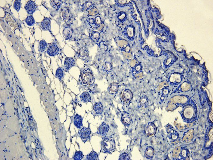 CD4 antibody