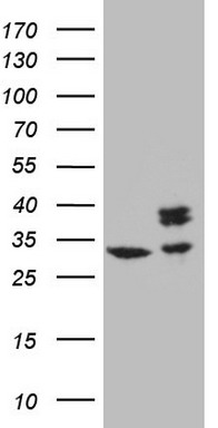 NCAM1 (CD56) Antibody