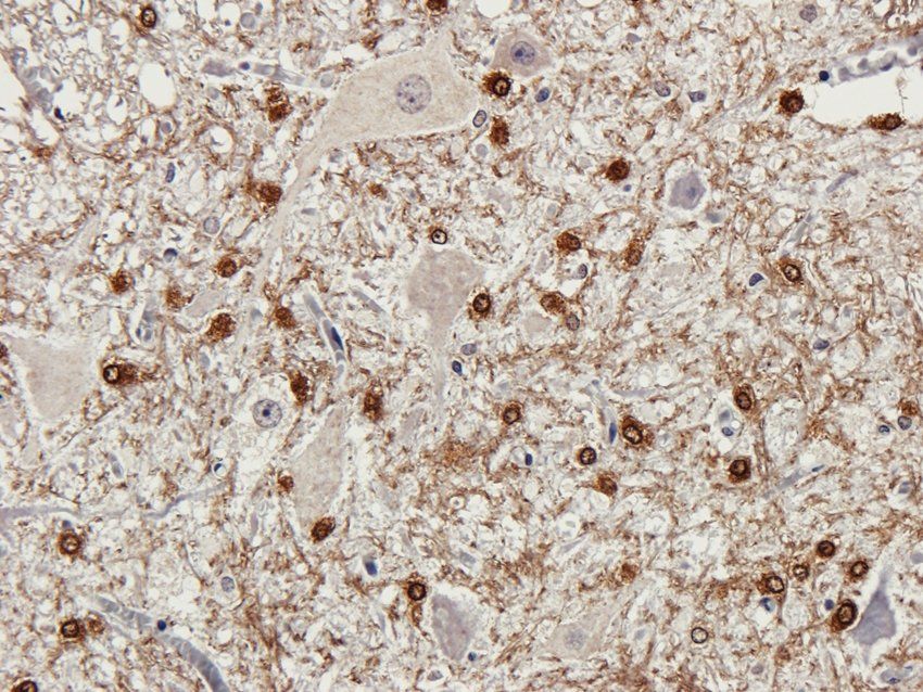 CD57 antibody