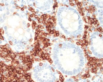 Human CD5 Antibody