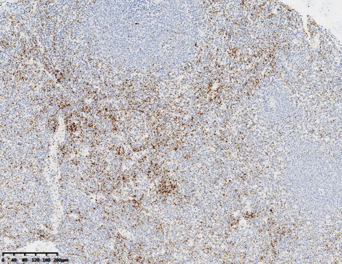 CD61 Antibody