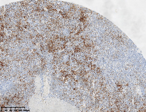 CD61 Antibody