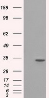 CD61 Antibody