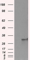 CD61 Antibody