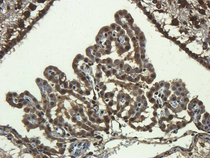CD68 antibody