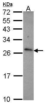 CKLF like MARVEL transmembrane domain containing 6 Antibody