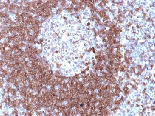 CD79A Antibody