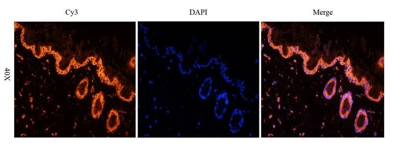 CD81 antibody