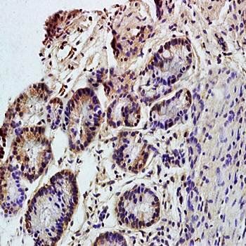 CD98 Rabbit Polyclonal Antibody