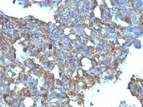 CD99 Antibody