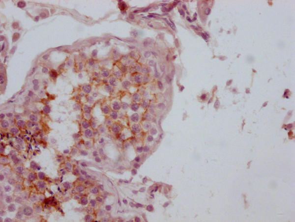 CD99 Antibody