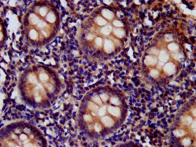 CD99L2 Antibody