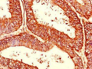 CDC34 Antibody