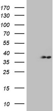 CDC42BPA Antibody