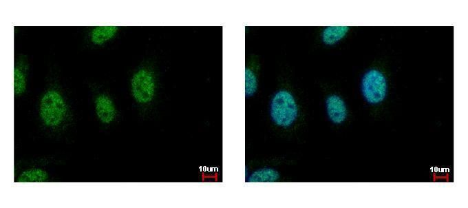 CDC45L Rabbit Polyclonal Antibody