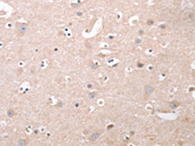 CDCA4 Antibody