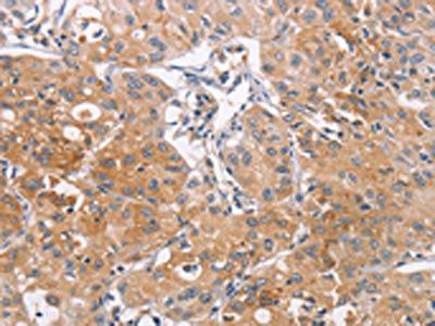CDCA4 Antibody