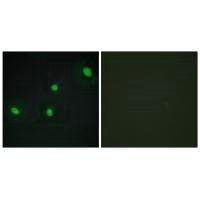 CDCA4 Antibody