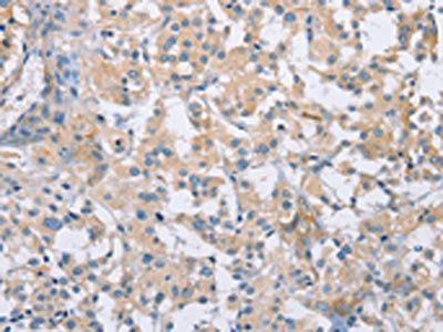 CDCP1 Antibody