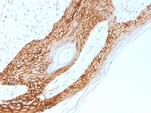 CDH1 Antibody