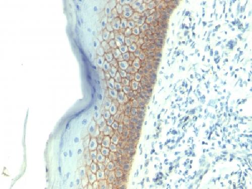 CDH1 Antibody