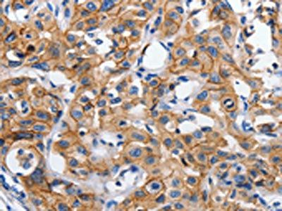 CDH1 Antibody