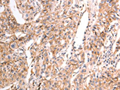 CDH1 Antibody