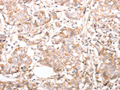 CDH1 Antibody
