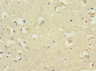 CDH10 Antibody