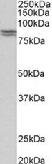 CDH1 (aa662-675) Antibody