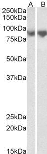 CDH1 (aa662-675) Antibody
