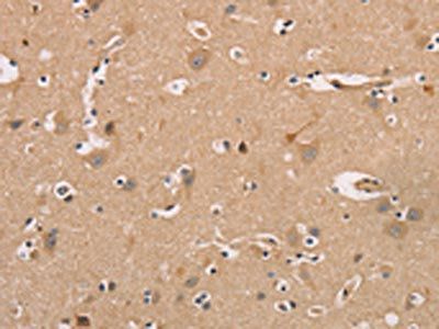 CDK11A/CDK11B Antibody